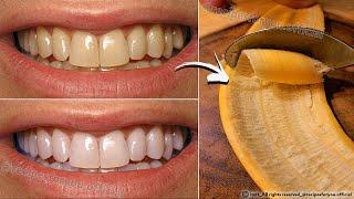 Secret that Dentists don't want you to know: Remove Tartar and Teeth Whitening in just 2 minutes🪥