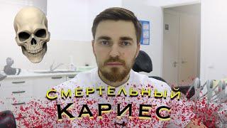 Смертельный кариес! Можно ли умереть от кариеса?