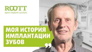 Отзыв пациента по одномоментной имплантации зубов в клинике ROOTT. Исправление ошибок протезирования