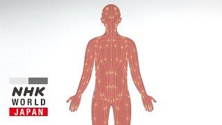 Acupuncture to Improve Quality of Life - Medical Frontiers