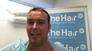 Ben Thornley Hair Transplant Journey