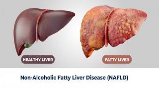 Revitalize Your Liver: Top 8 Foods to Cure Liver Disease: A Doctor's Guide