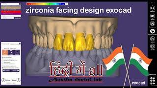 zirconia facing design exocad HINDI & exocad bridge design, exocad smile design,