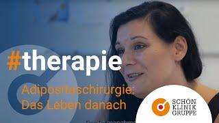 Adipositaschirurgie – Das Leben danach | Schön Klinik Hamburg Eilbek
