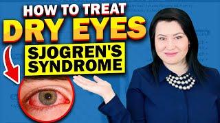 Dry Eyes | Sjogren's Syndrome: Treatment Tips