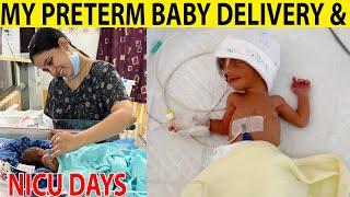 C-section Delivery Story of My PRE TERM Baby  33 weeks delivery story- part 2