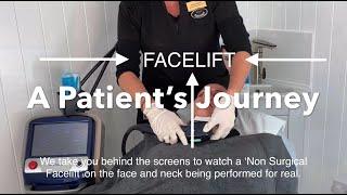 Non Surgical Facelift For Neck - My Experience Having A Non Surgical Facelift