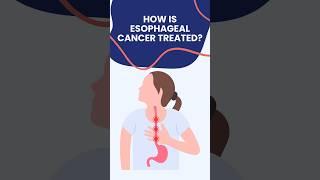 Esophagus cancer treatment in Delhi Noida @DrAshishSachan