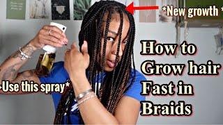 HOW TO MAINTAIN AND GROW HAIR FAST IN BOX BRAIDS| PROTECTIVE STYLE MAINTENANCE