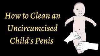 How to Clean an Uncircumcised Child's Penis