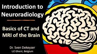 Basics of CT and MRI of the brain: introduction to Neuroradiology.