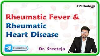 6: Rheumatic Fever and Rheumatic heart disease  | Pathology USMLE Step 1