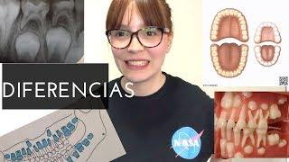 Diferencias entre Dentición temporal y permanente