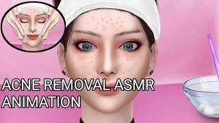 acne removal asmr animation | juday vlog and probinsyana ado