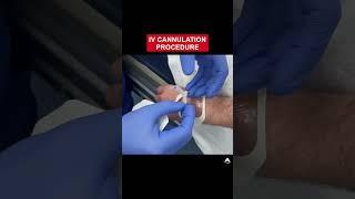 IV Cannulation Procedure | #shorts #ivcannulation #anesthesiology #nurse