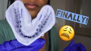 UNBOXING IMPRESSION KIT !! I JOINED THE SMILE DIRECT CLUB!!  | @MEEKFRO VLOG