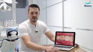 Коронка и имплантация зуба. Капранов М. Ю. Клиника Dr. Smile