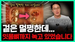 (주의) 늦을수록 큰일 나는 치아 통증 | 통증별 응급 점수 알려드립니다
