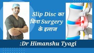 बिना Surgery के Slip Disc का इलाज