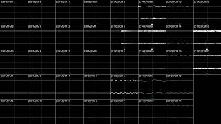 31 Week Krystal-clear Ahead (ESFM + C140 2MB)