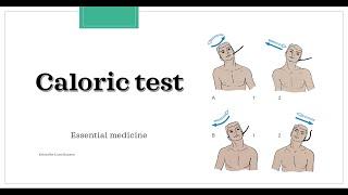 Caloric test [Essential medicine]