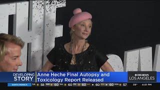 Anne Heche's final autopsy and toxicology report released