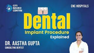 Dental Implant Procedure Explained | Dr. Astha Guptha #dentalcare