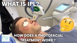 What is IPL? | How Does an IPL Intense Pulsed Light PHOTOFACIAL TREATMENT Work? | Pūr Skin Clinic