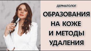 Образования на коже и методы удаления