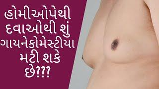CAN GYNECOMASTIA BE TREATED WITH HOMEOPATHY MEDICINE EXPLAINED IN GUJARATI BY PLASTIC SURGEON