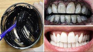 In 2 minutes, the white teeth whitening and globe such as pearls, this recipe treatment at home 100%