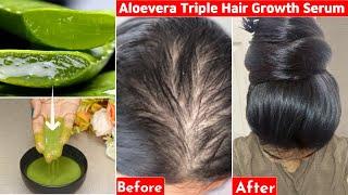 ThisAloevera Trick-Turned My Bald Hair to Thick Heavy Hair- 30 Days-Hair Loss to Thick Dense Hair