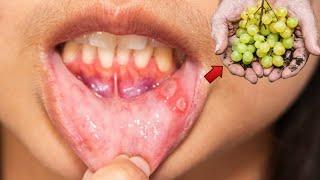 अंगूर खाने के फायदे | Angur khane ke fayde | Angoor khane ke fayde | Grapes benefits