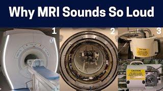 What Makes The Different MRI Scan Sounds? Knocking to Rhythmic Chirping MRI Sounds Explained