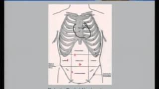 Recovery After Nephrectomy Ed Rampersaud, M.D.