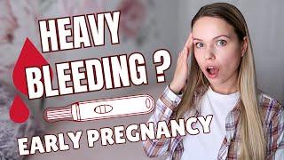 THIS IS WHY YOUR "Heavy Implantation Bleeding"  IS A CONCERN | Can I Be Pregnant And Have Period