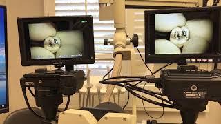 Why metering is important for endodontic photography: Sony A6000 vs CanonT3i