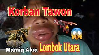 Korban Tawon (Lombok Utara) Mamiq Alua, gara-gara metik jambu mente/jambu monyet