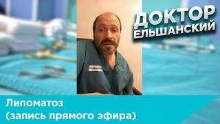Липоматоз (запись прямого эфира)