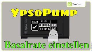 YpsoPump Basalrate programmieren, Insulinpumpe mylife Diabetescare 03