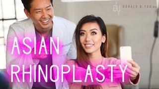 Model Undergoes Revision Asian Rhinoplasty with Rhinoplasty Specialist - Dr. Donald B. Yoo, M.D.