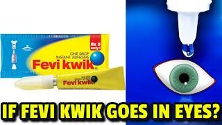 15 Shocking Facts of What if Fevi Kwik goes in your Eyes