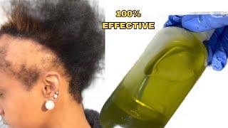 This was the only hair growth treatment that grew her hair back like crazy!
