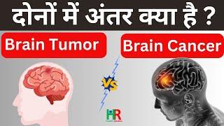 brain tumor and brain cancer in hindi | ब्रेन ट्यूमर और ब्रेन कैंसर की पूरी जानकारी हिंदी में |