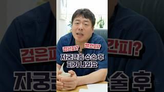 자궁근종 수술 후 출혈 괜찮은가요?