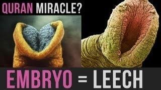 EMBRYO = LEECH  | AMAZING QURAN MIRACLE | #MINDBLOWING