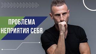 НЕПРИНЯТИЕ СЕБЯ - ЭТО ПУТЬ К БОЛЕЗНЯМ. Дмитрий Богацкий