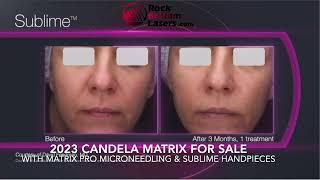 2023 Candela Matrix Laser for Sale