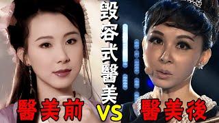 以為【退圈】實則被【醫美毀容】，8位女星變得面目全非，她卻讓人直呼可惜#周揚#劉競#劉雨欣#何琳#蕭薔#文夢洋#姚芊羽#溫嵐