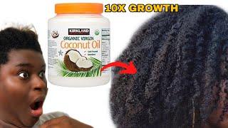  NO JOKE! HOW I USE PURE/ORGANIC COCONUT OIL FOR HAIR GROWTH IN 2 WEEKS!